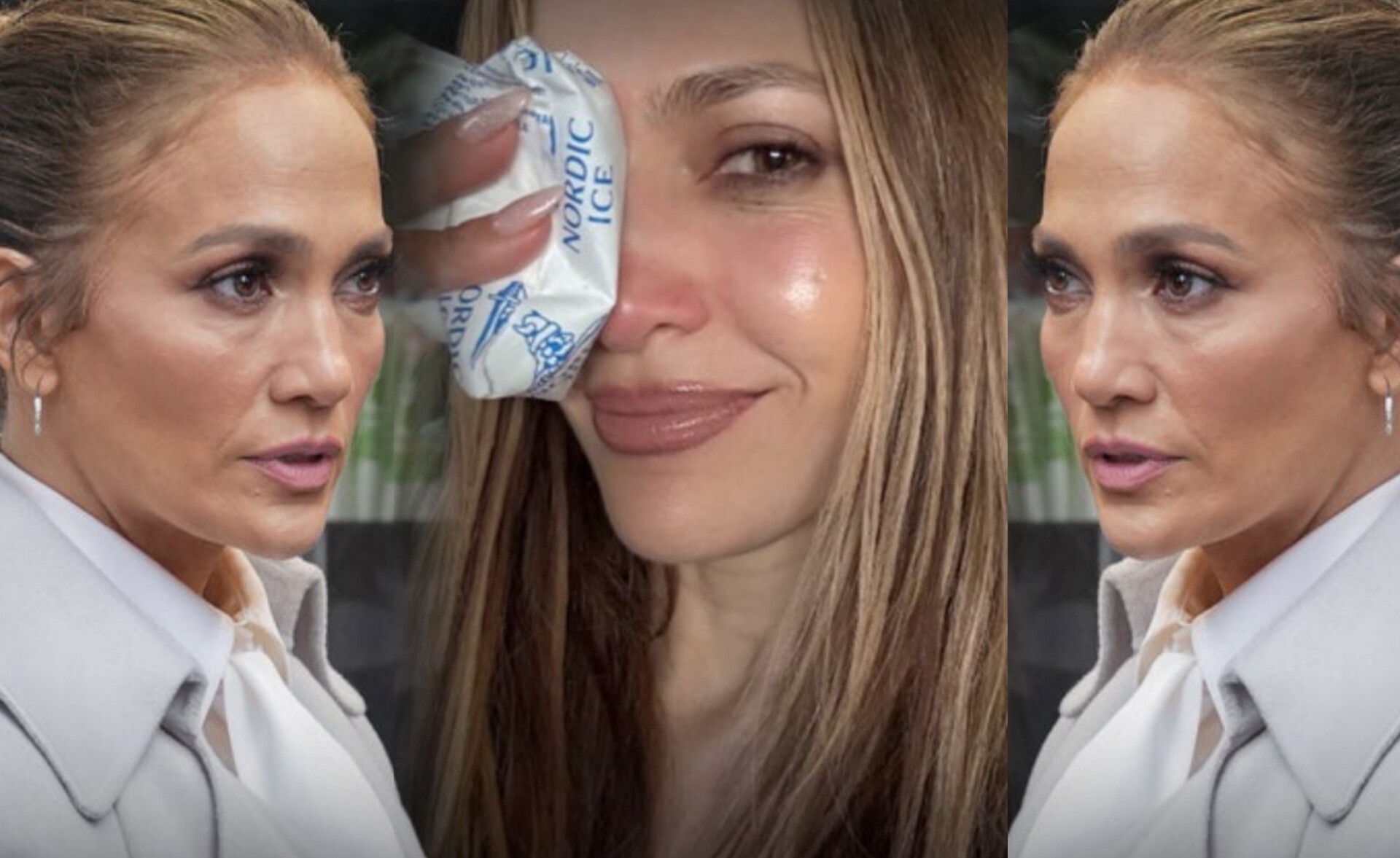 Jennifer Lopez Suffers Face Injury During AMA Rehearsals Needed Stitches Before Big Comeback