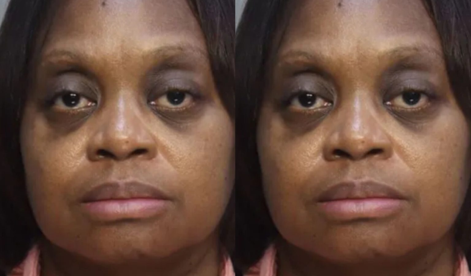 Nurse Rips Out Mom’s Breathing Tube in Front of Kids Says She Wanted Her to Die ‘Peacefully’