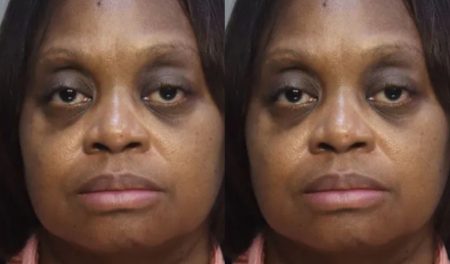 Nurse Rips Out Mom’s Breathing Tube in Front of Kids Says She Wanted Her to Die ‘Peacefully’